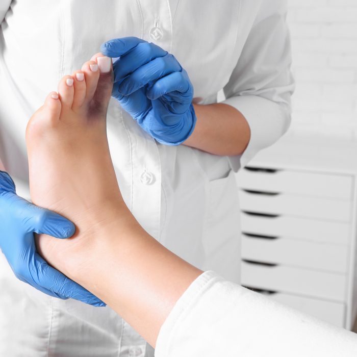 Home 70 doctor checking woman s foot with bruise hospital closeup.jpg